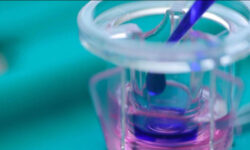 React4Life tra le prime 15 scaleup biotech in UE